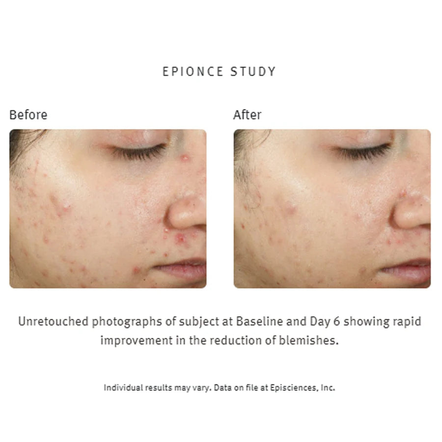 Epionce Purifying Spot Gel, 10ml