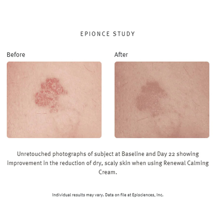 Epionce Renewal Calming Cream, 75g