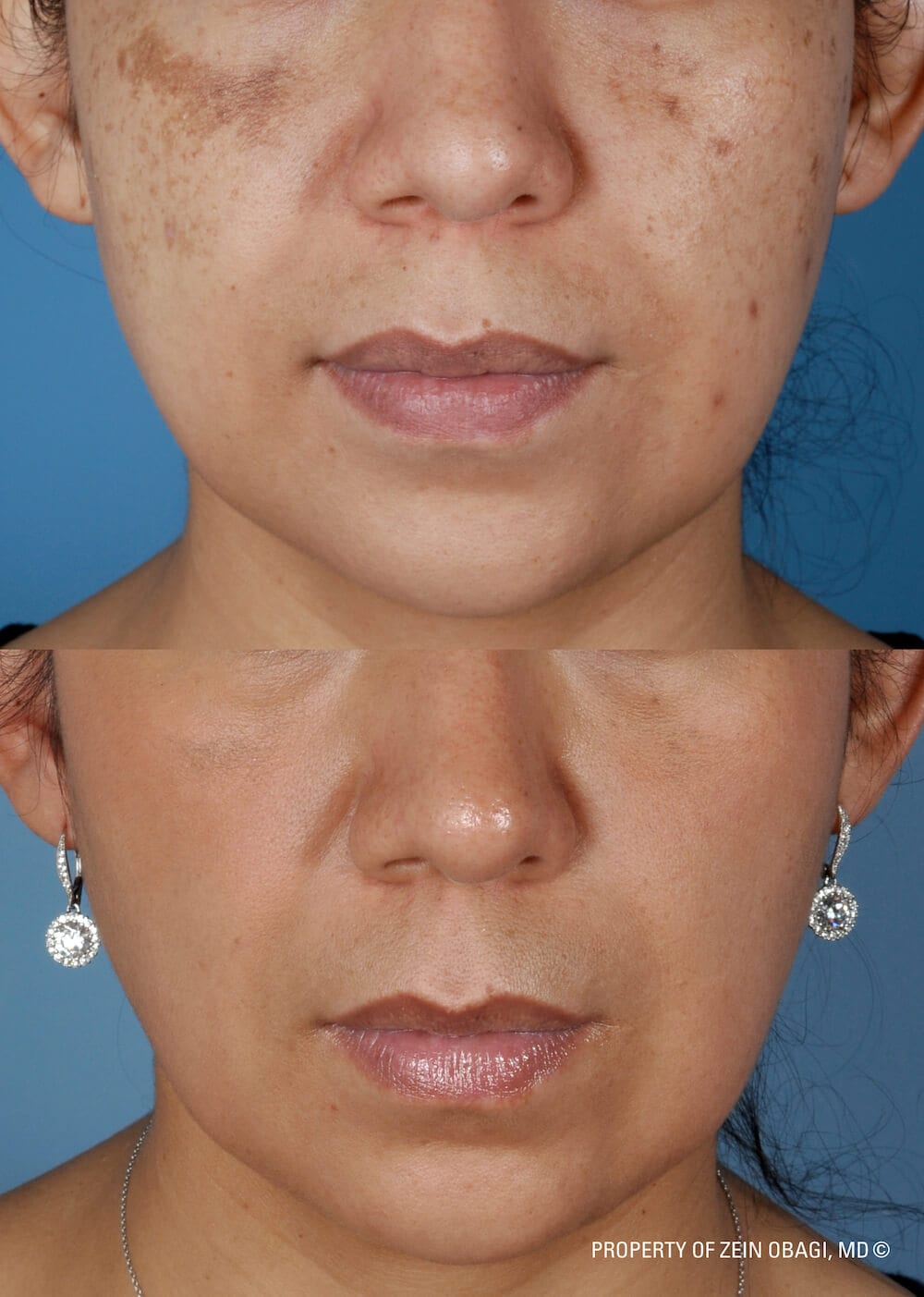 ZO Skin Health Pigment Control + Brightening Creme