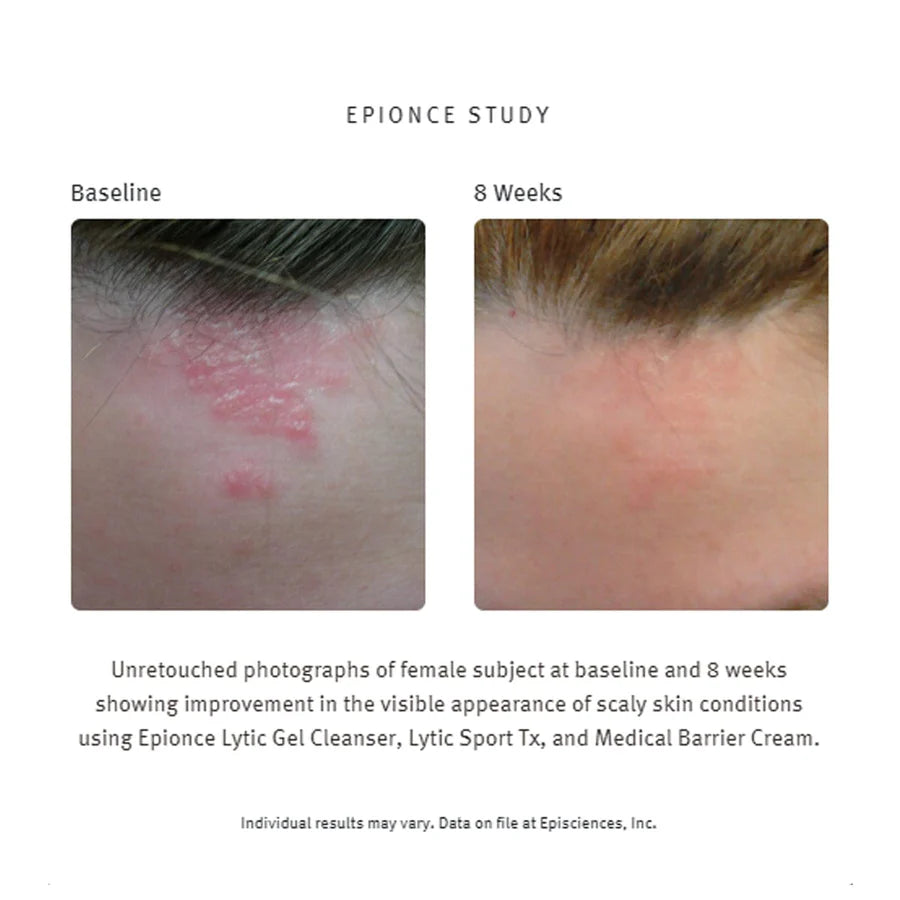Epionce Medical Barrier Cream, 230g