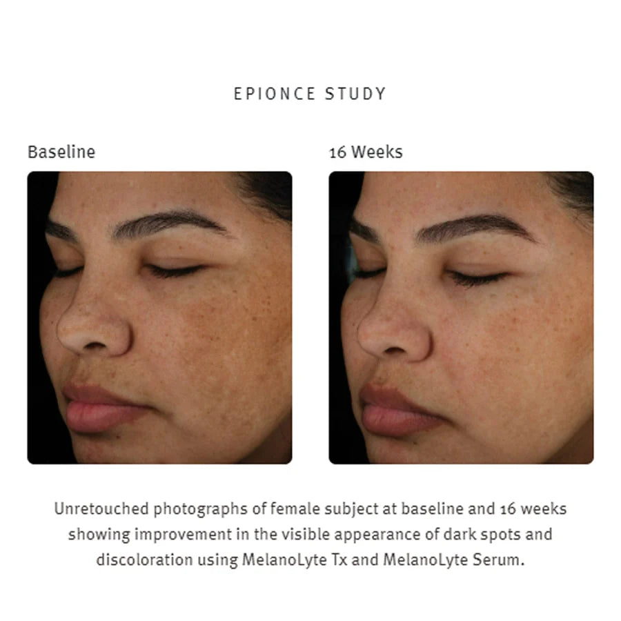 Epionce Melanolyte Serum, 30ml
