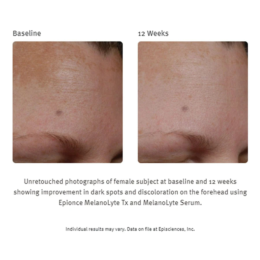 Epionce Melanolyte Serum, 30ml
