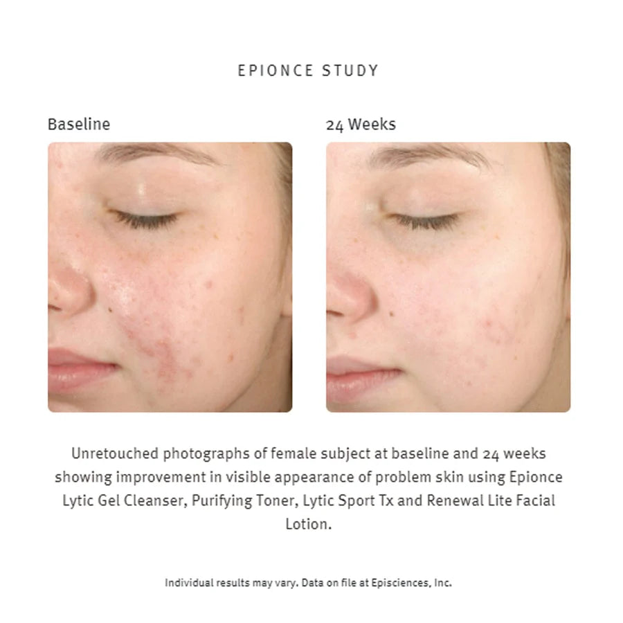Epionce Purifying Toner, 120ml